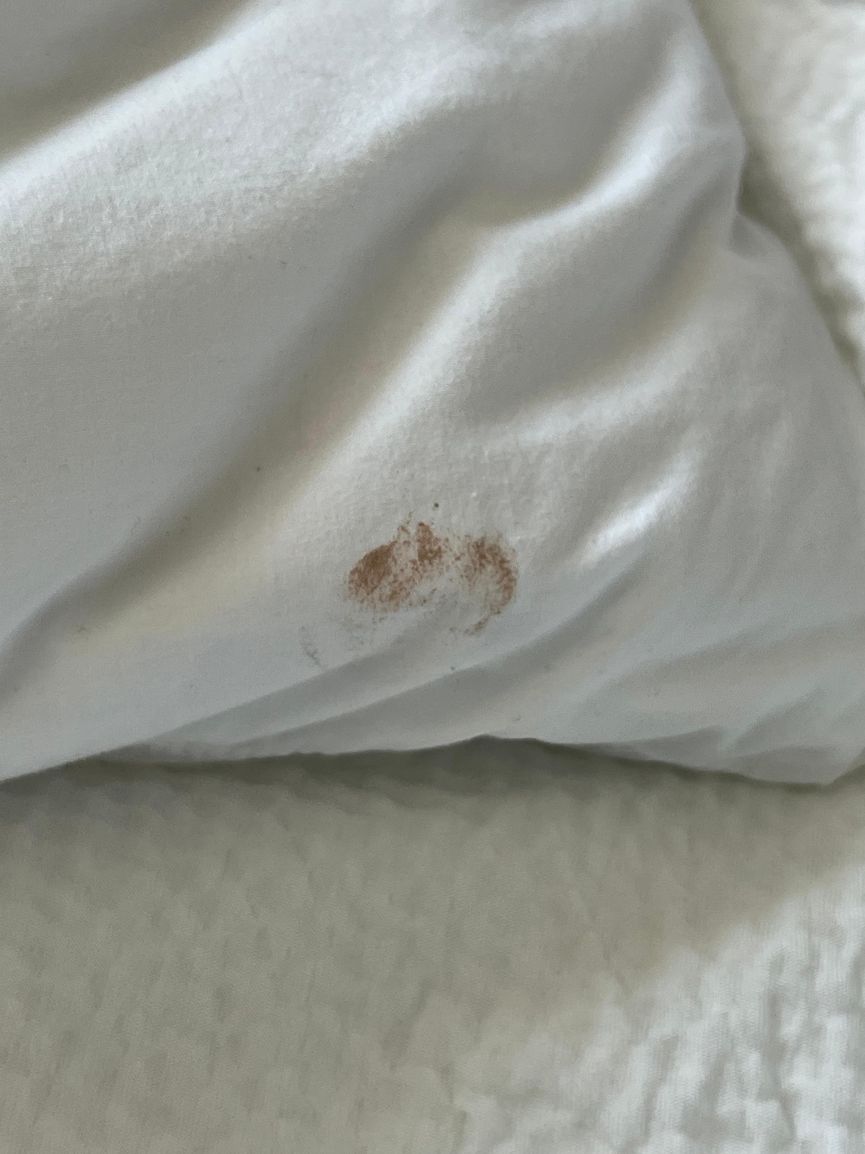 Blood stain!