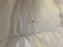 Blood on comforter
