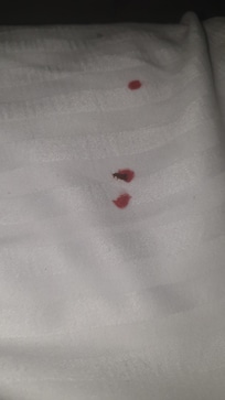 Found this in the morning of my departure. I was glad to be leaving the morning I found this.