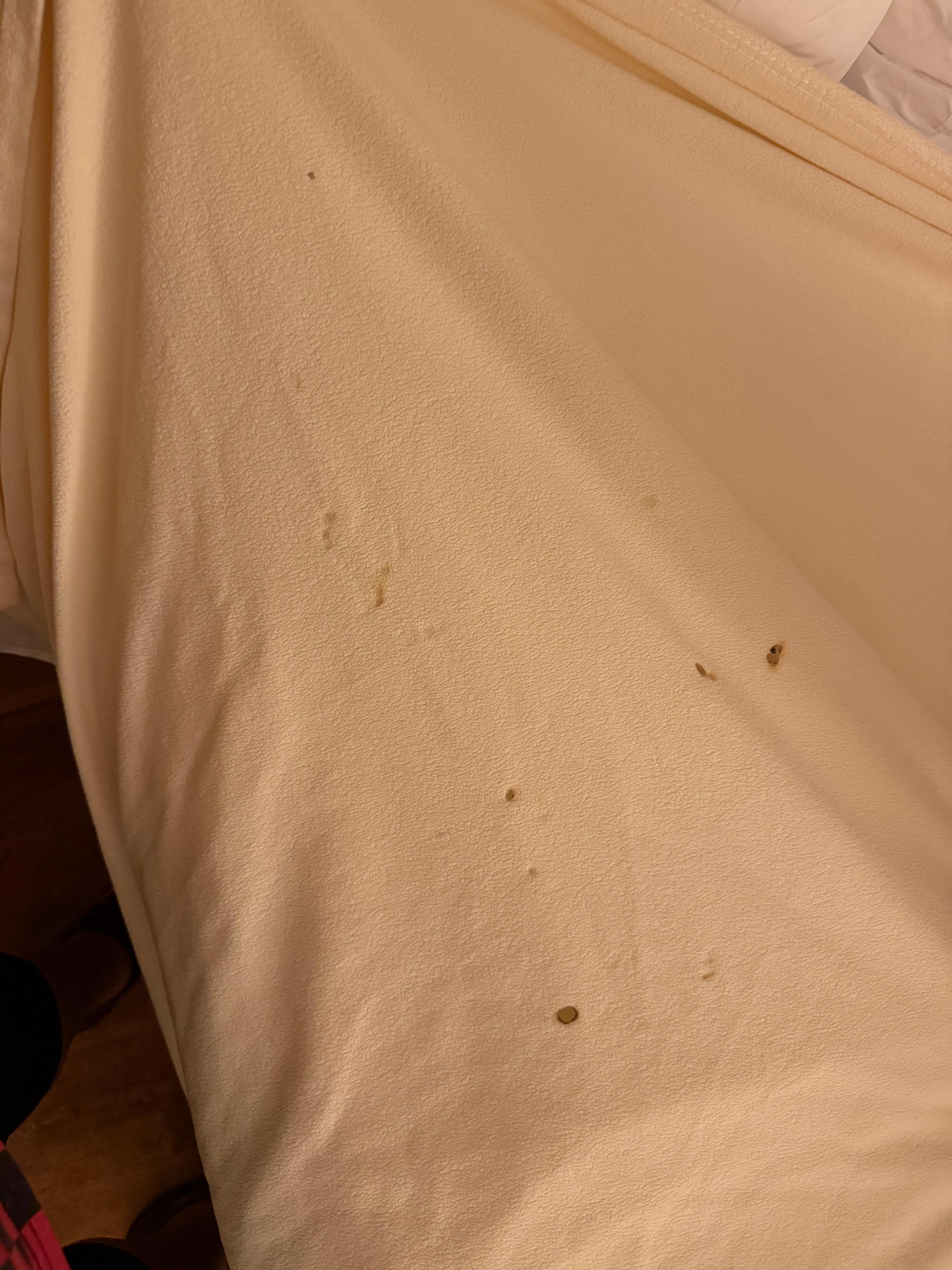 Sheets had cigarette burns 