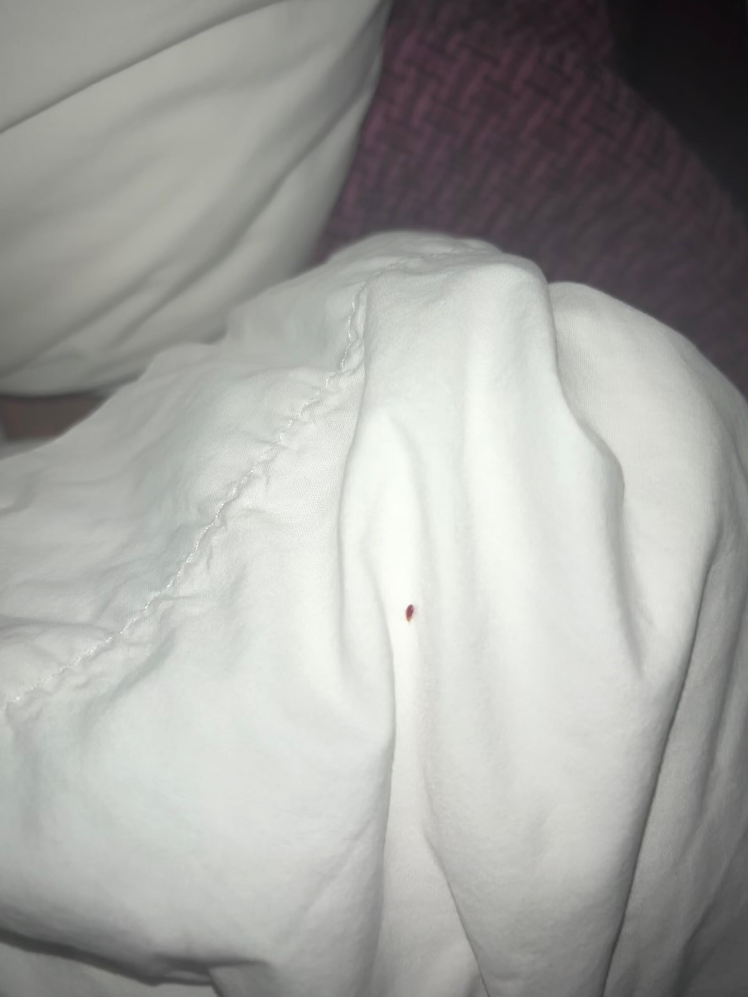 Unfortunately it doesn’t look like Expedia allows video, but here’s a photo of the little guy.