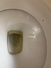 Dirty toilet