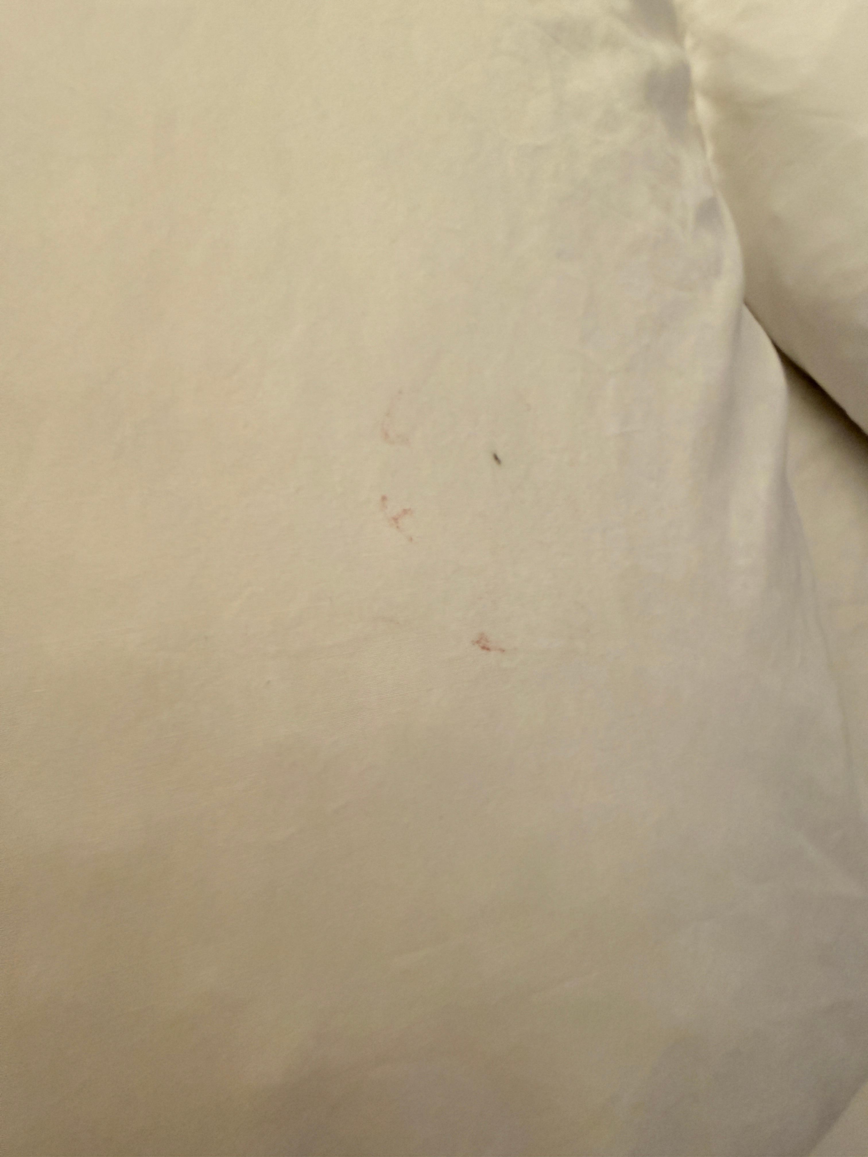 Bellows covers are dirty 