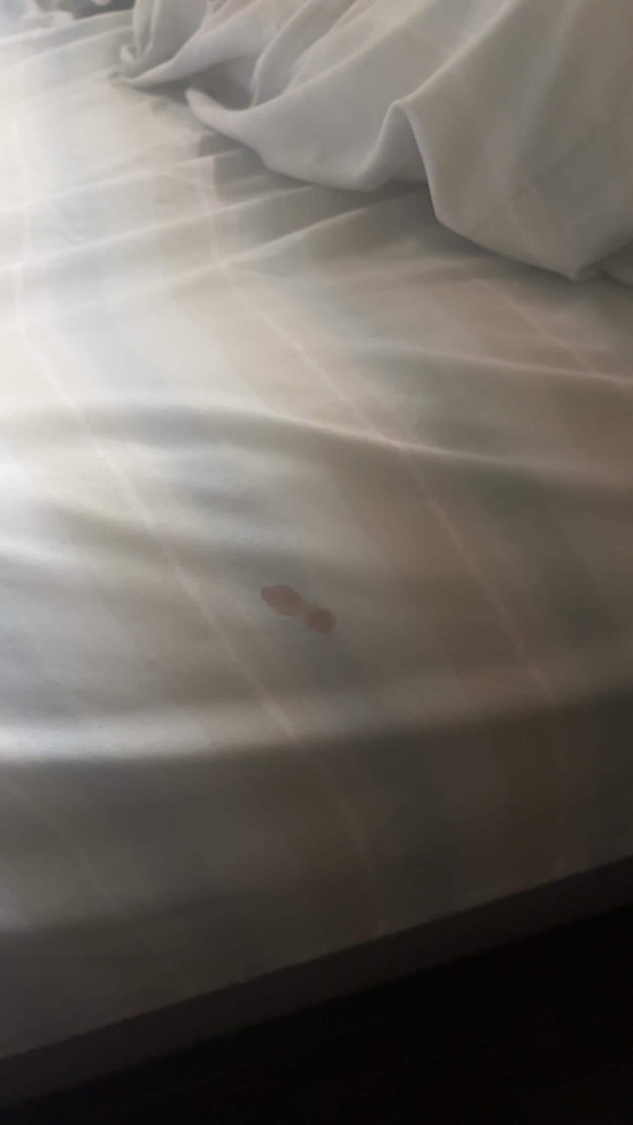 A stain of sorts on the sheets. It looks like blood 