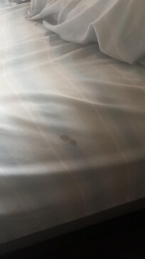 A stain of sorts on the sheets. It looks like blood