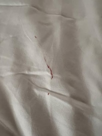 blood stain on sheets