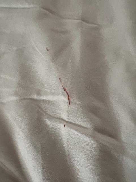 blood stain on sheets