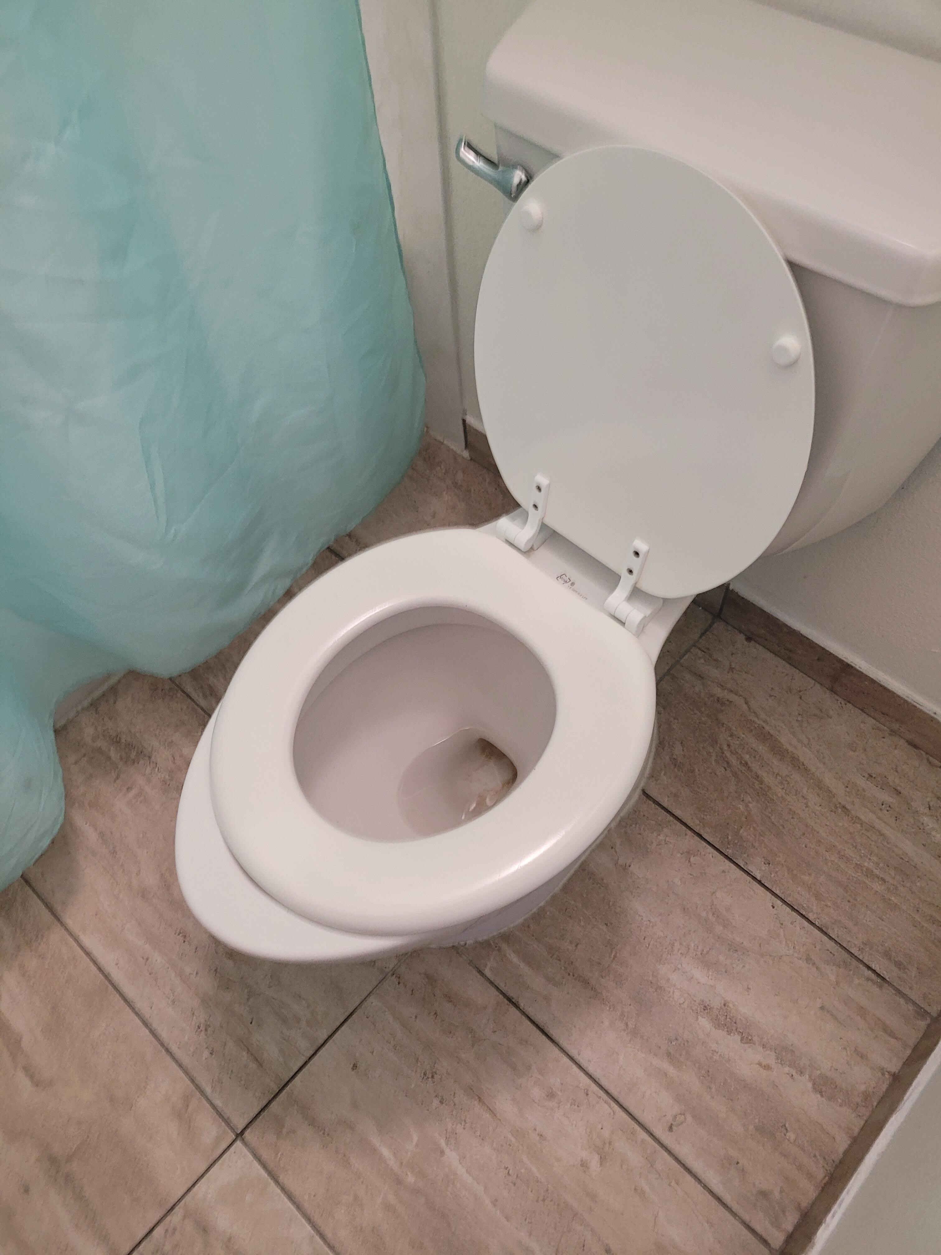 Ridiculous fitting toilet seat.