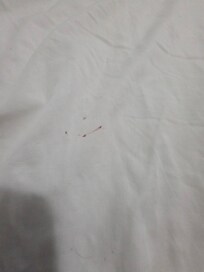 Blood spot on the sheets