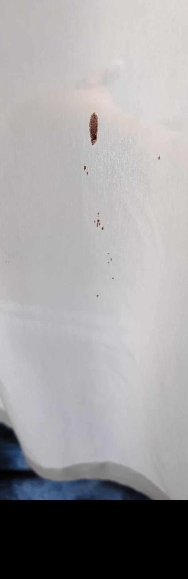 Blood stains on the curtains in the room ( and not ours!)