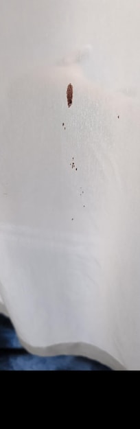 Blood stains on the curtains in the room ( and not ours!)