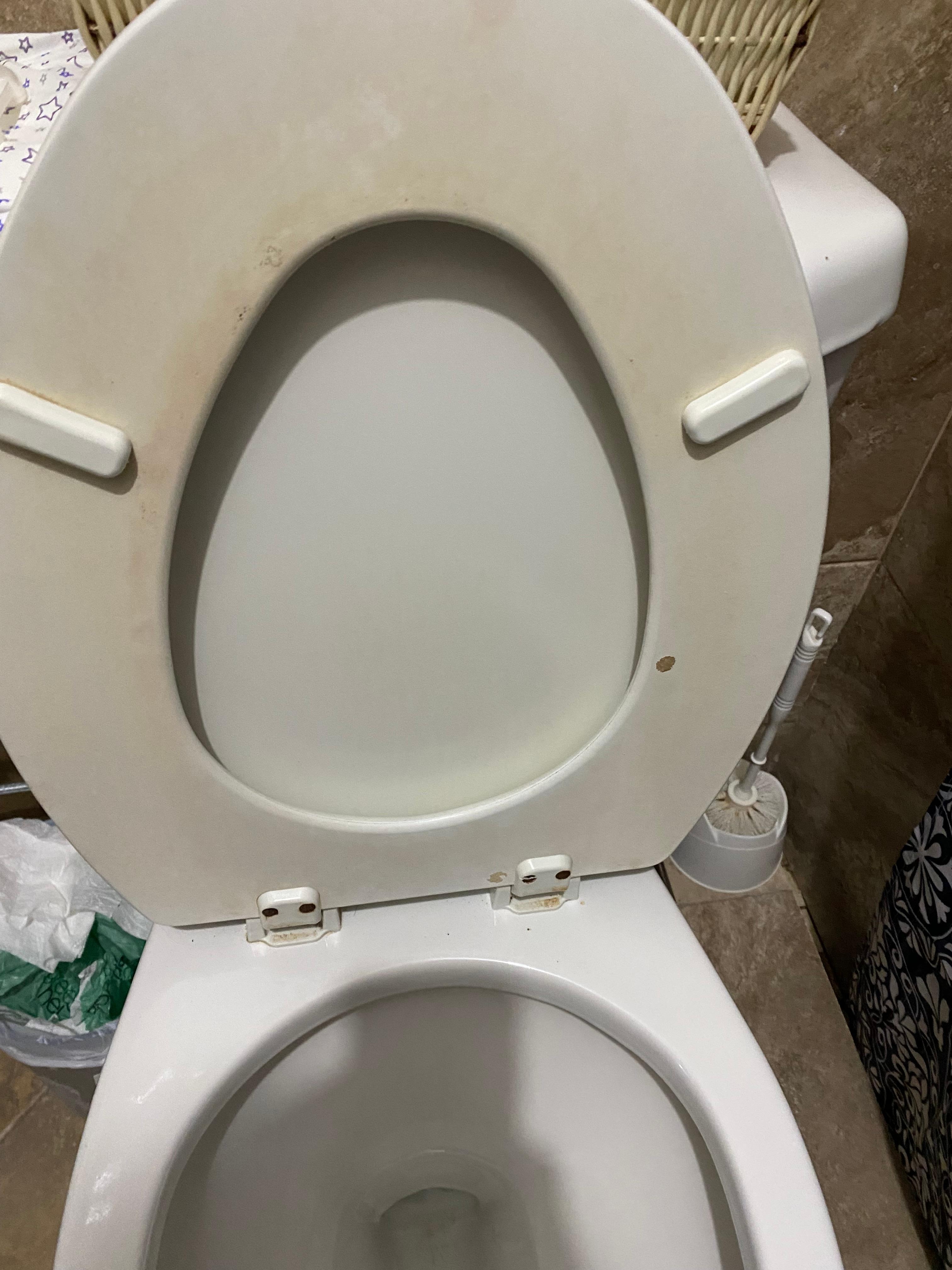 Toilet stains with urine 