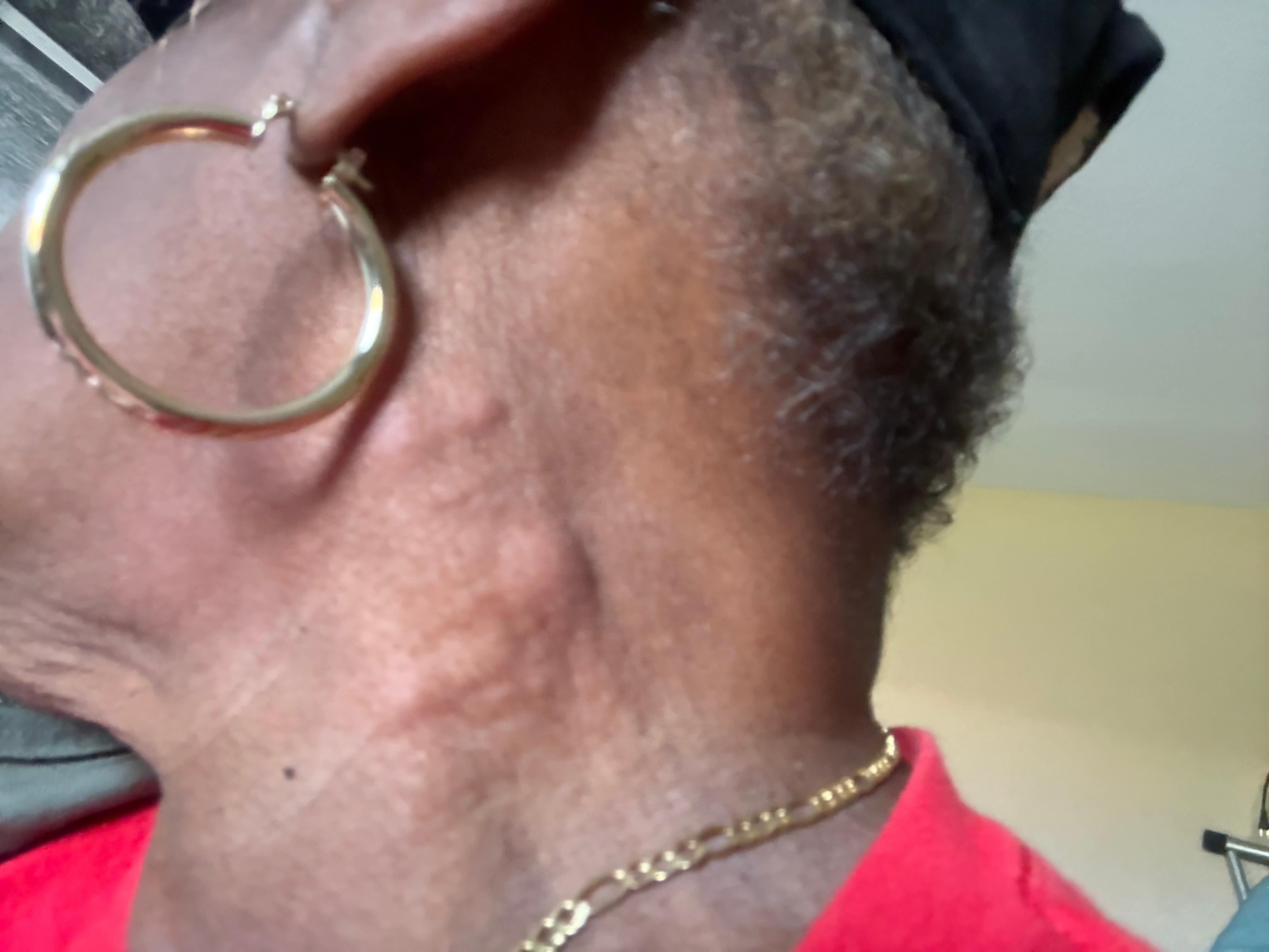 This is picture of my neck