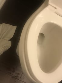 Loose toilet seat
