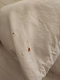 Blood stains on pillow before we put clean cases on.