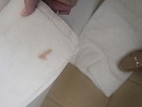 Stained towels