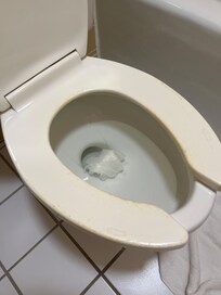Dirty toilet