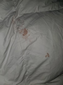 Blood stains/Yellow stains