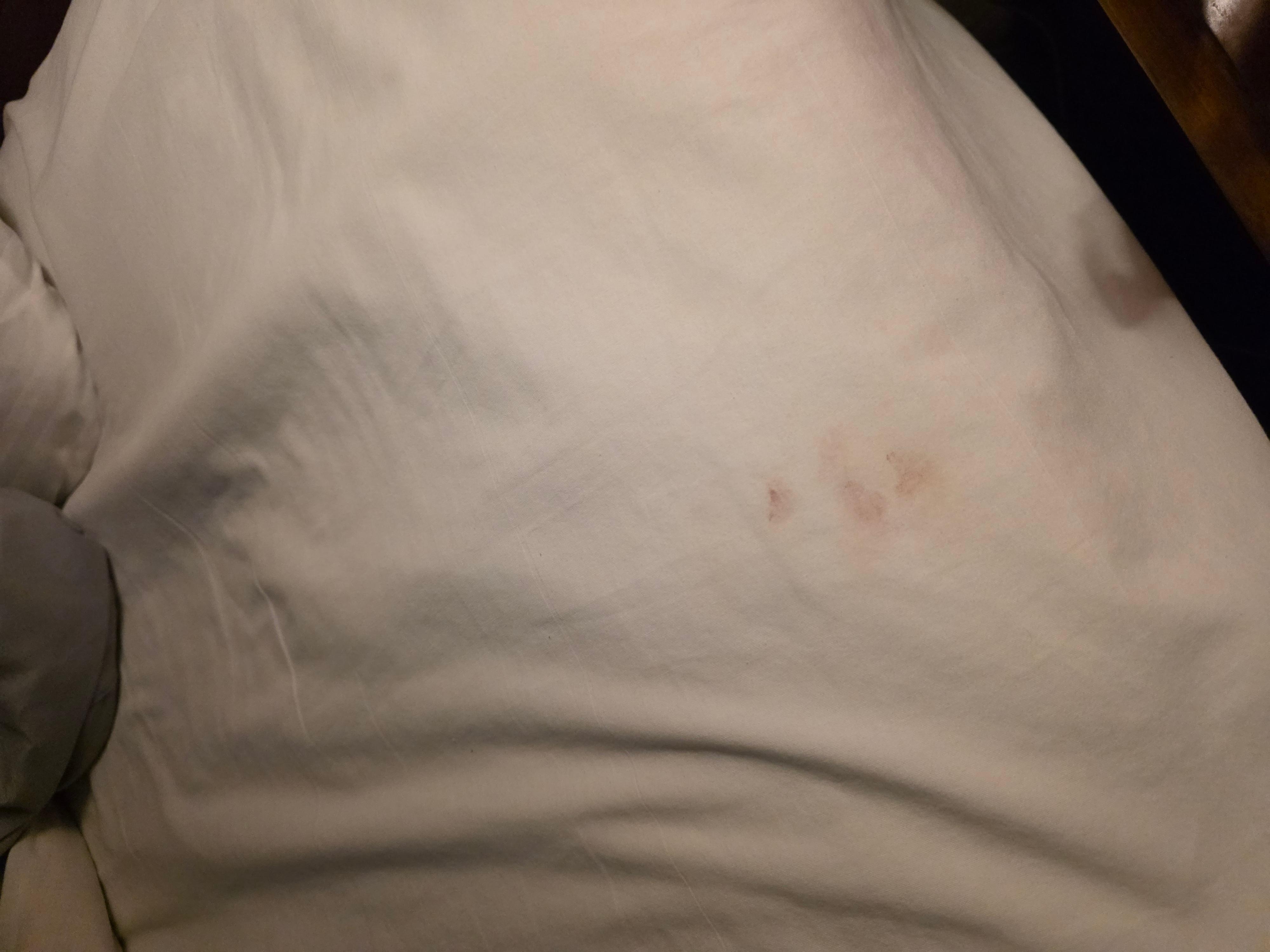 Stain on sheet looks like blood.