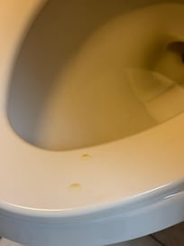 Urine on the toilet seat.