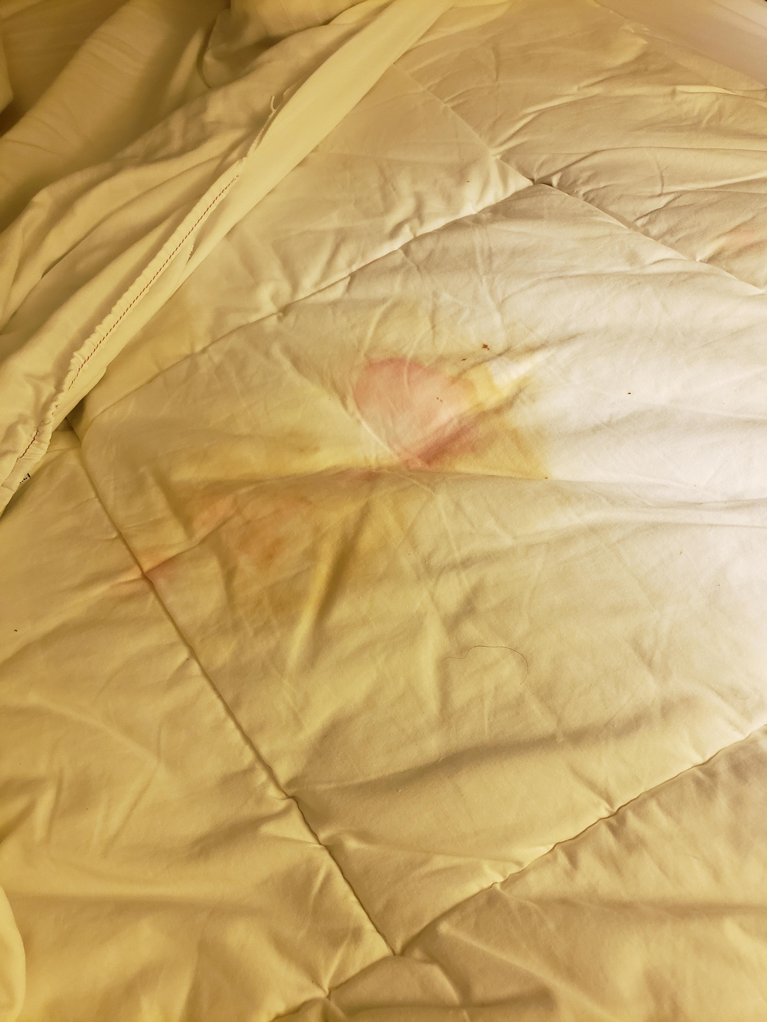 Looked like blood stains on bottom sheet. Thank goodness there was a clean sheet on top of this one.