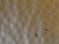 Dried Blood on Comforter