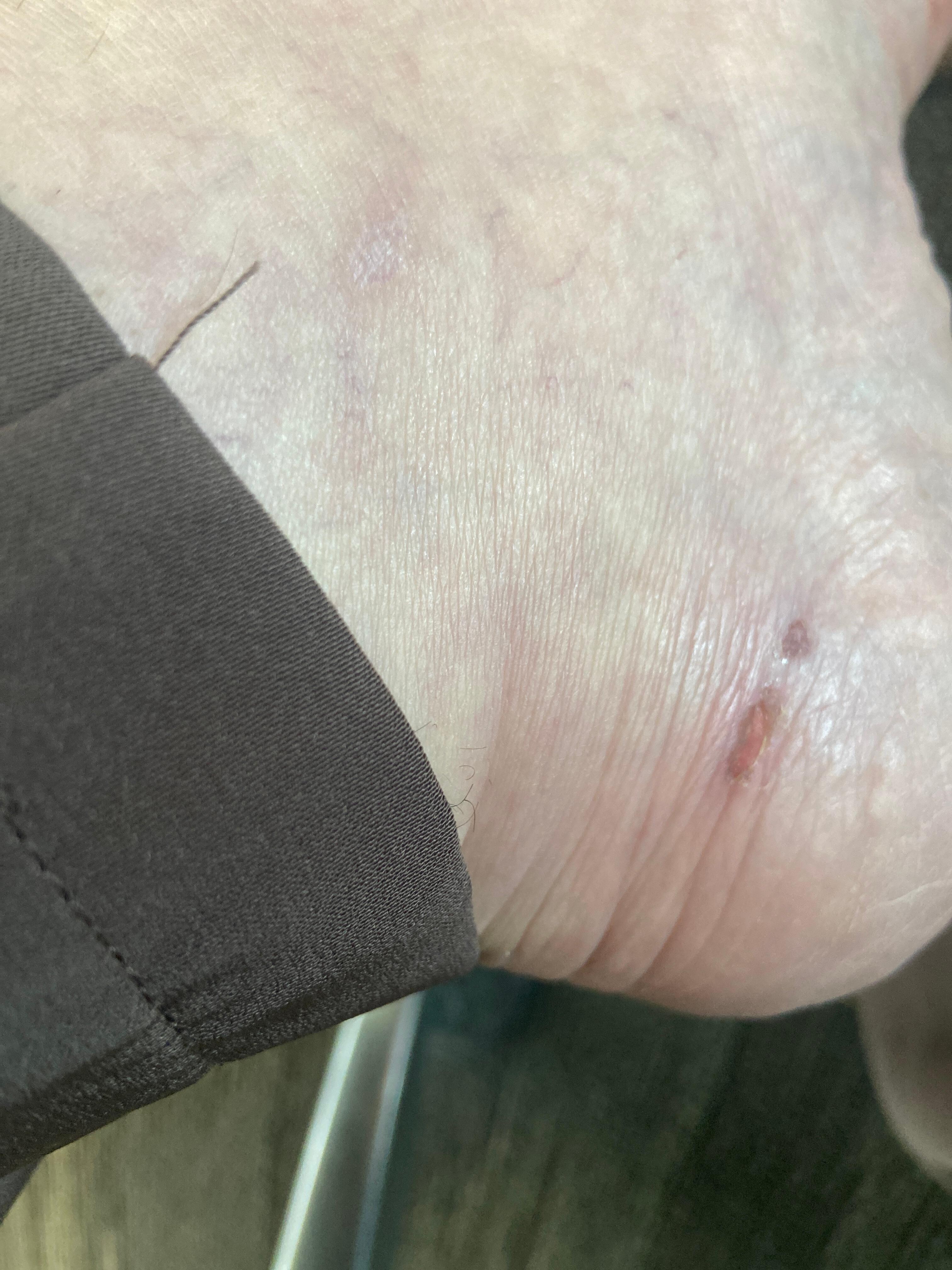 Injury from the pool glass