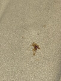 Cockroaches in blankets