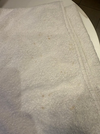 The gross stuff on our towels