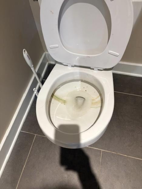 A dirty toilet