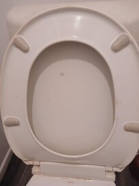 Stating the obvious, filthy toilet.