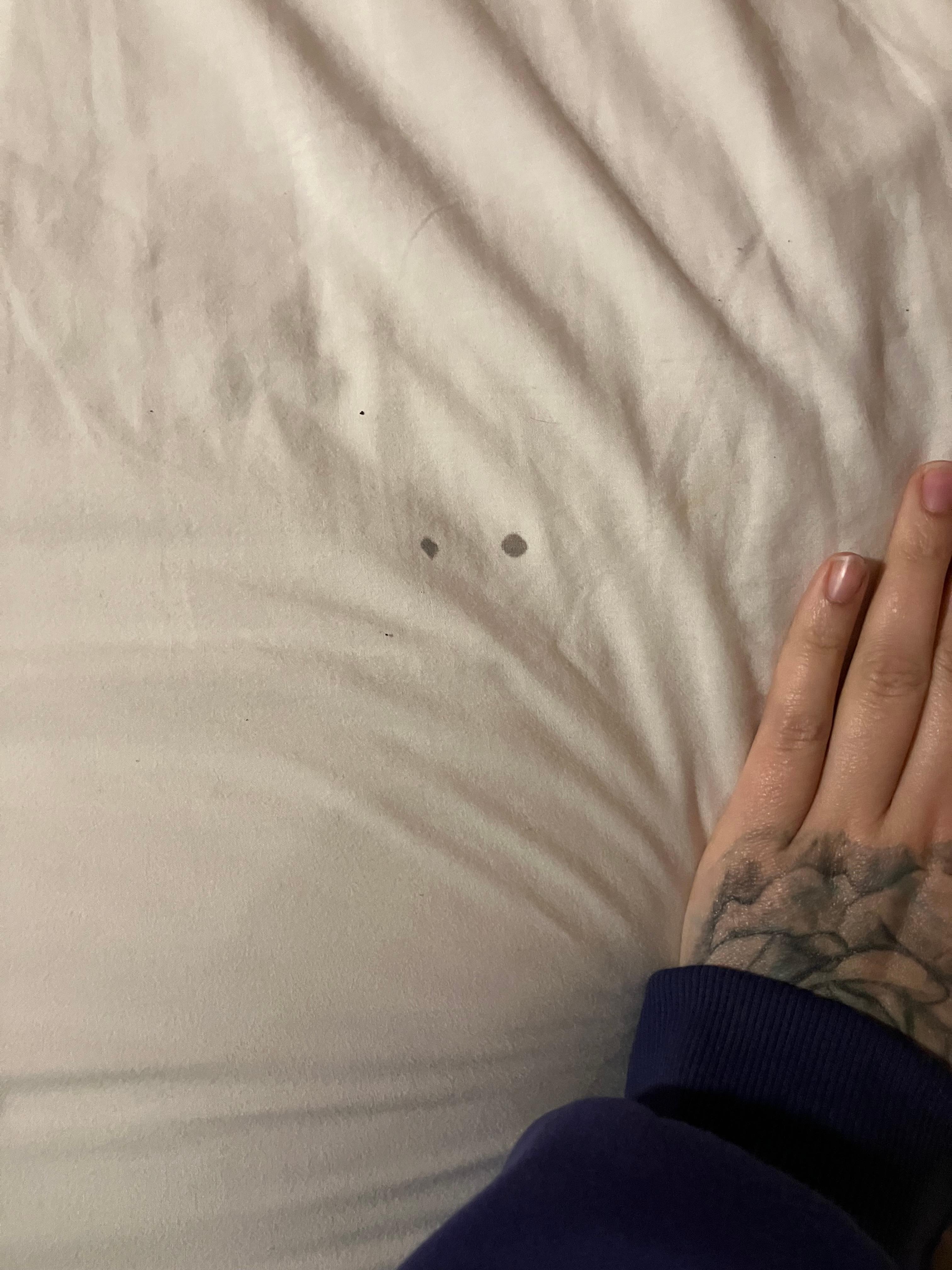 Assuming old blood stain on the bed aheet