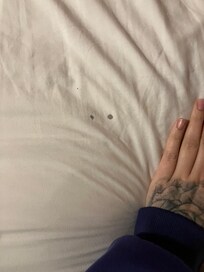 Assuming old blood stain on the bed aheet