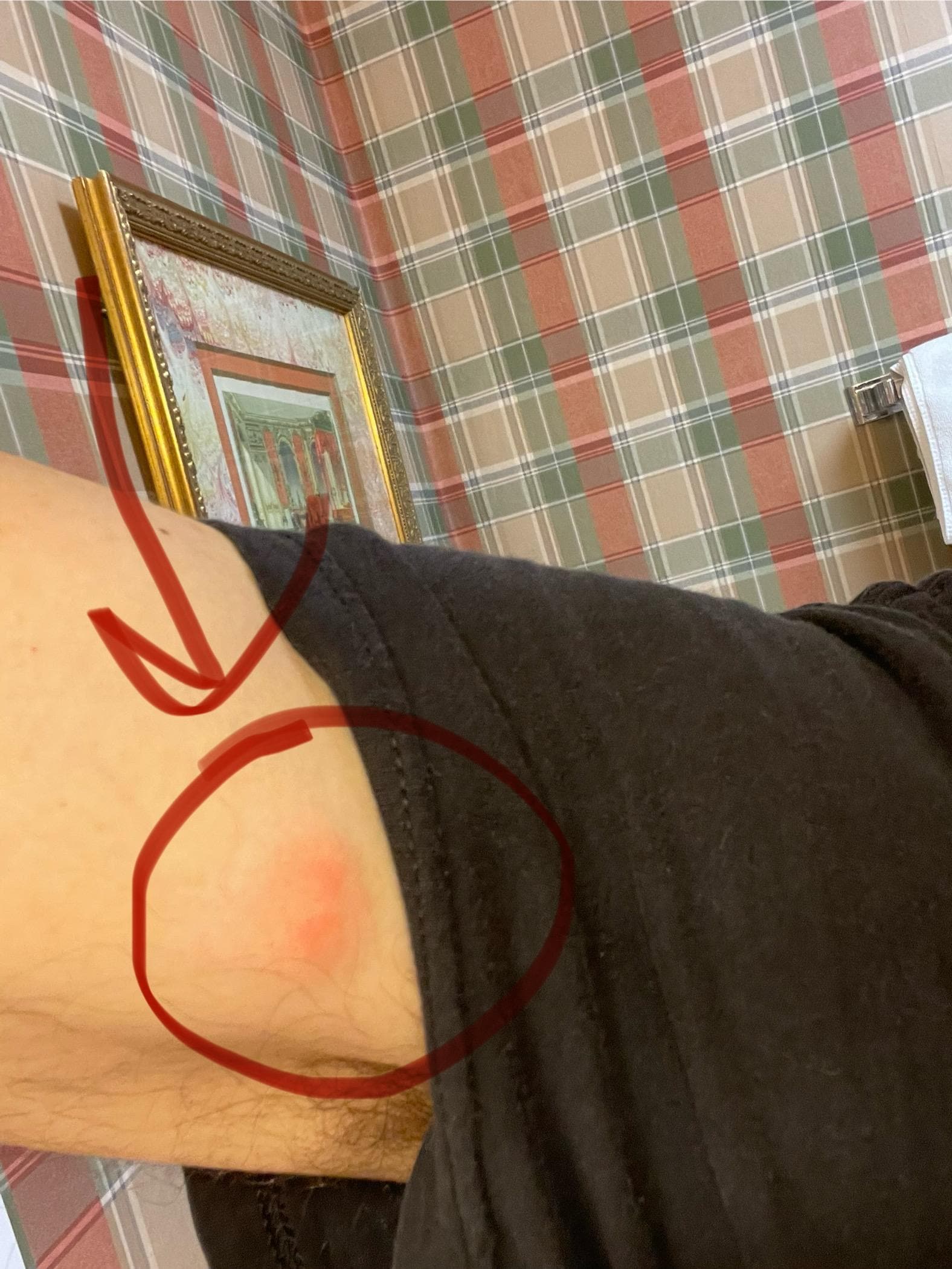 Does this look like its from shaving??