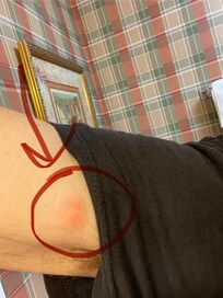 Does this look like its from shaving??