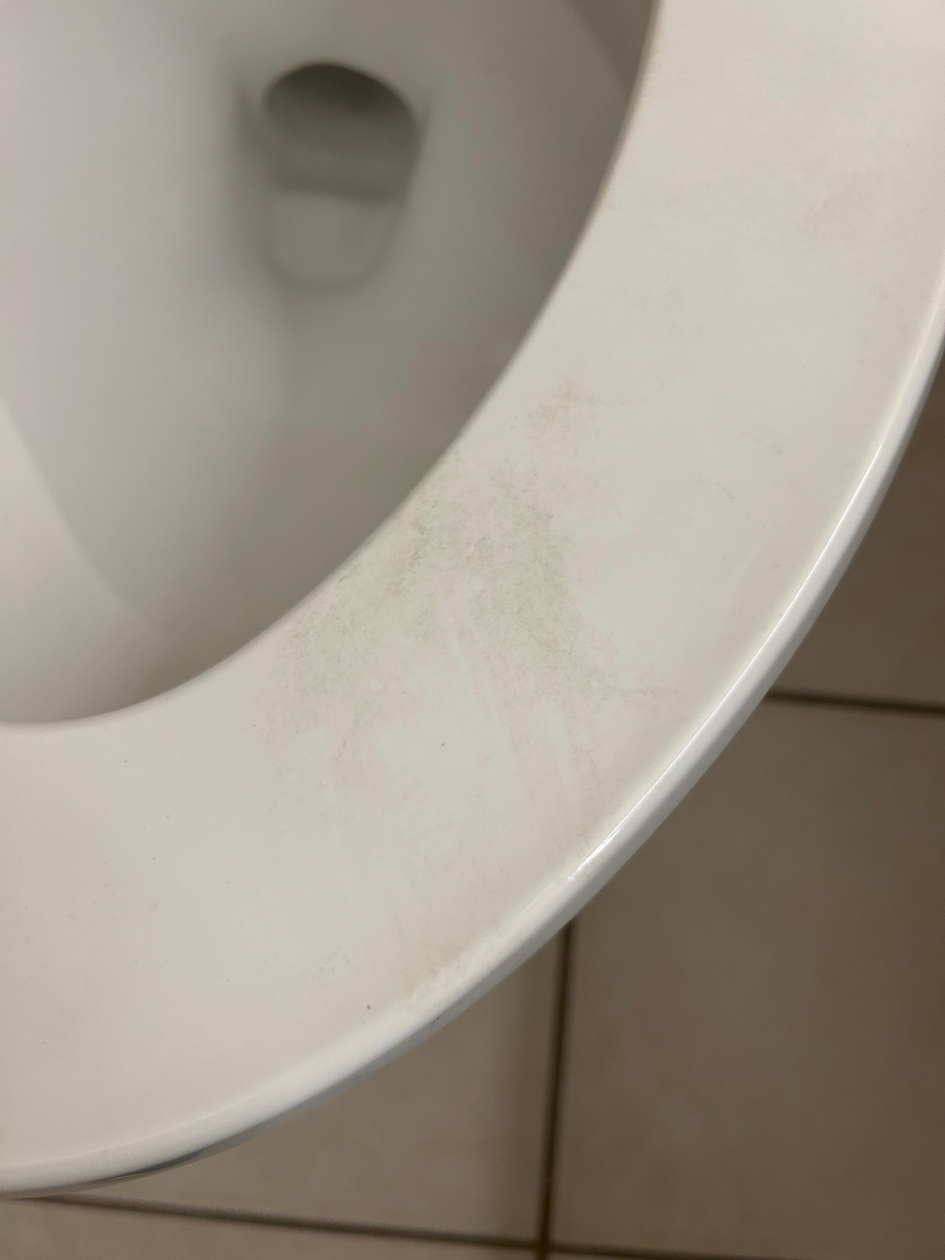Dirty toilet seat