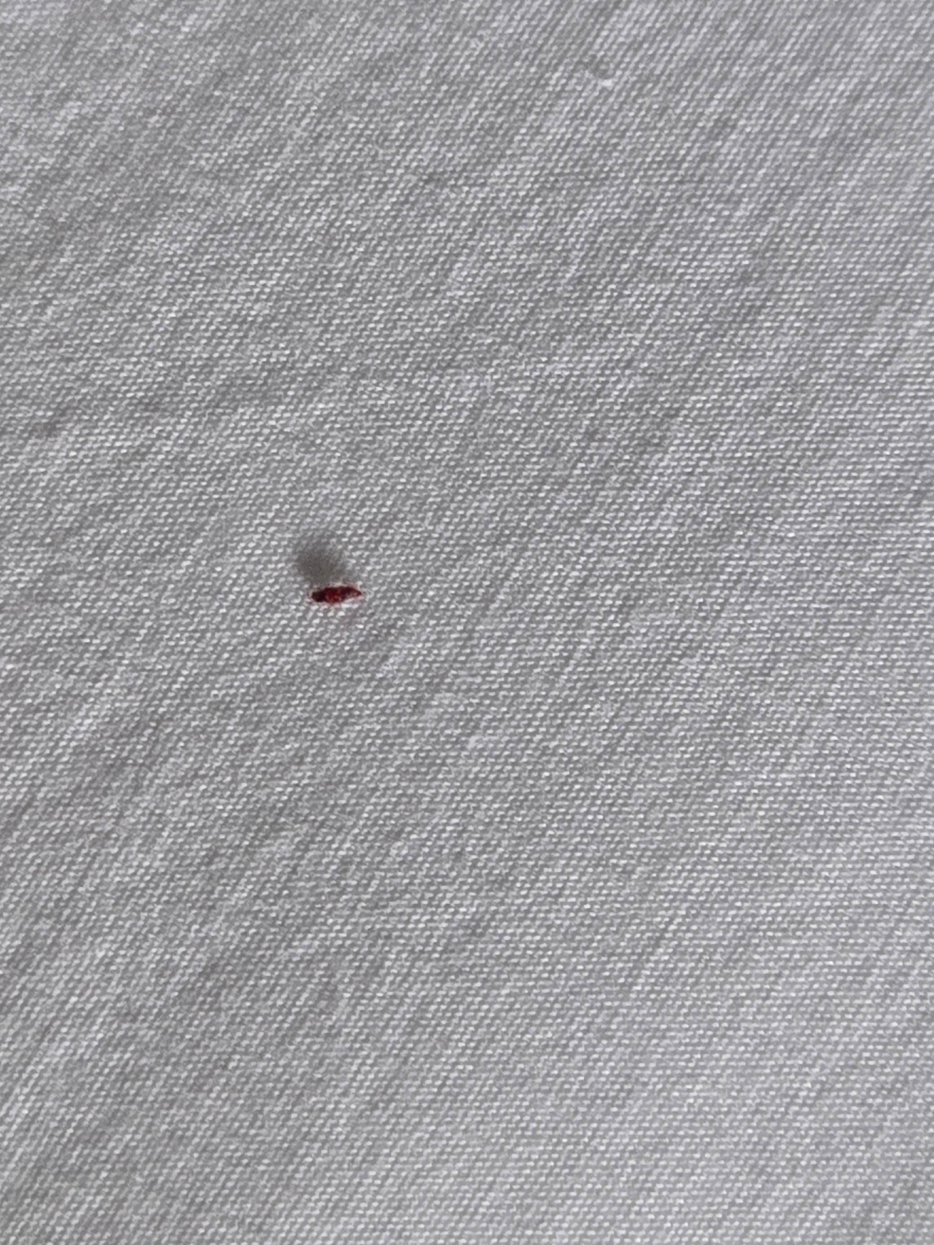 Bed bugs in 1st room