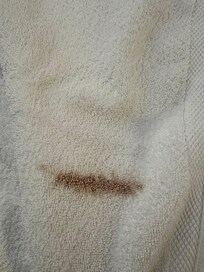 Dirty towels in our room