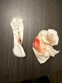 Thank you for ripping out my cochlear amplifier and now I need 3 months of rehab. Imani is not my fiancee. Heās a rapist.