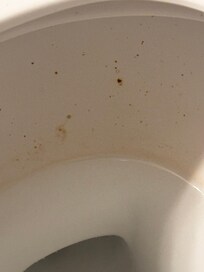 Toilet poop stains