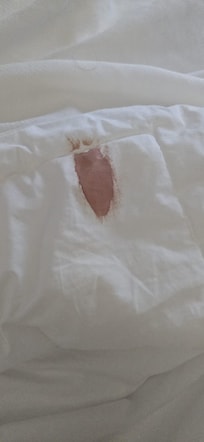 Someone's blood or menstrual stains on the duvet.