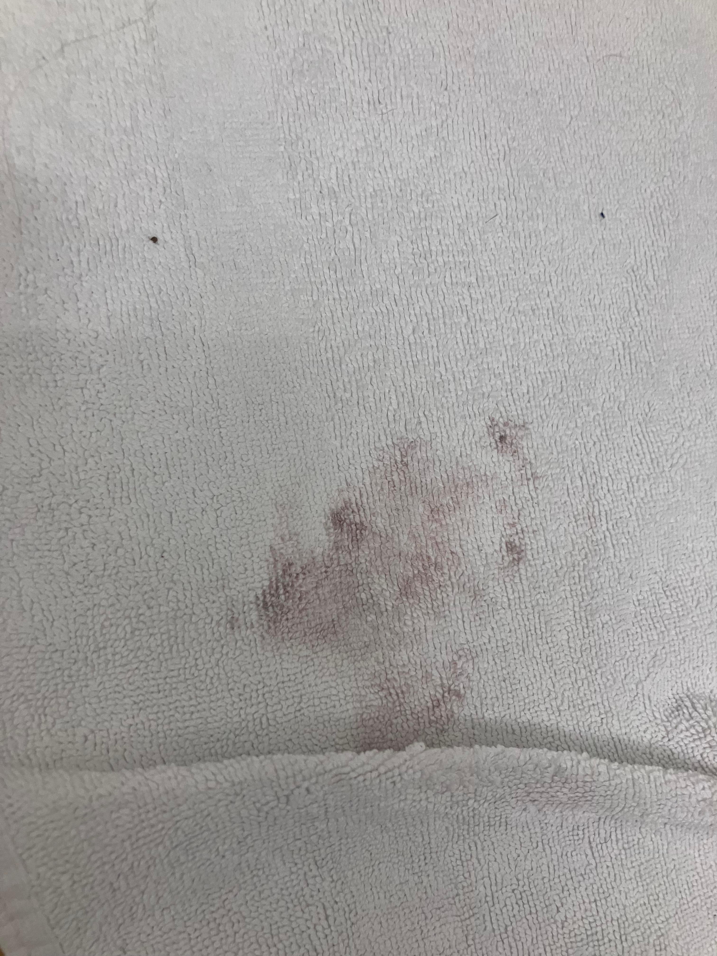 Mysterious mark on bathroom floor mat