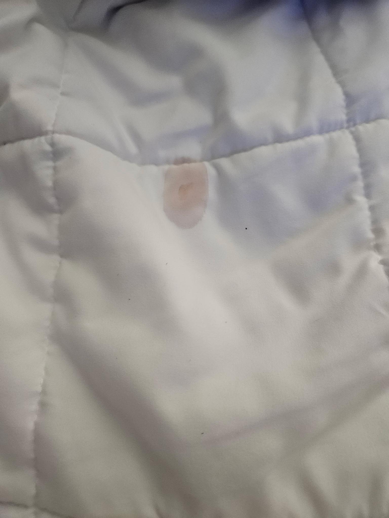 Blood on sheets