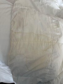 Urine on bed comforter. It was hidden well on the lower part of the mattress where our legs and feet was rubbing on.