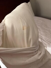 Blood on the pillows