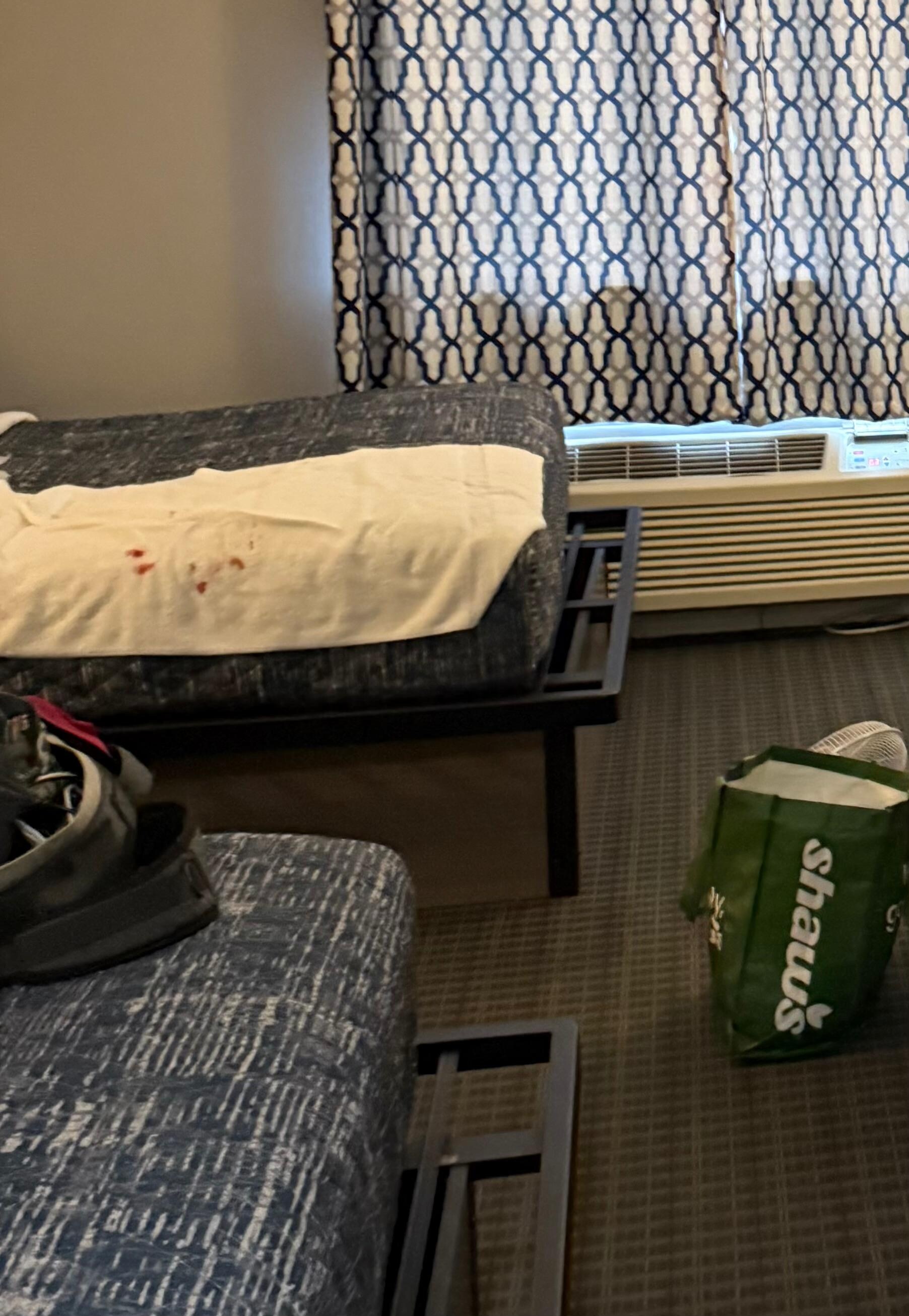 See the bloody towel waiting for us when we entered our room.