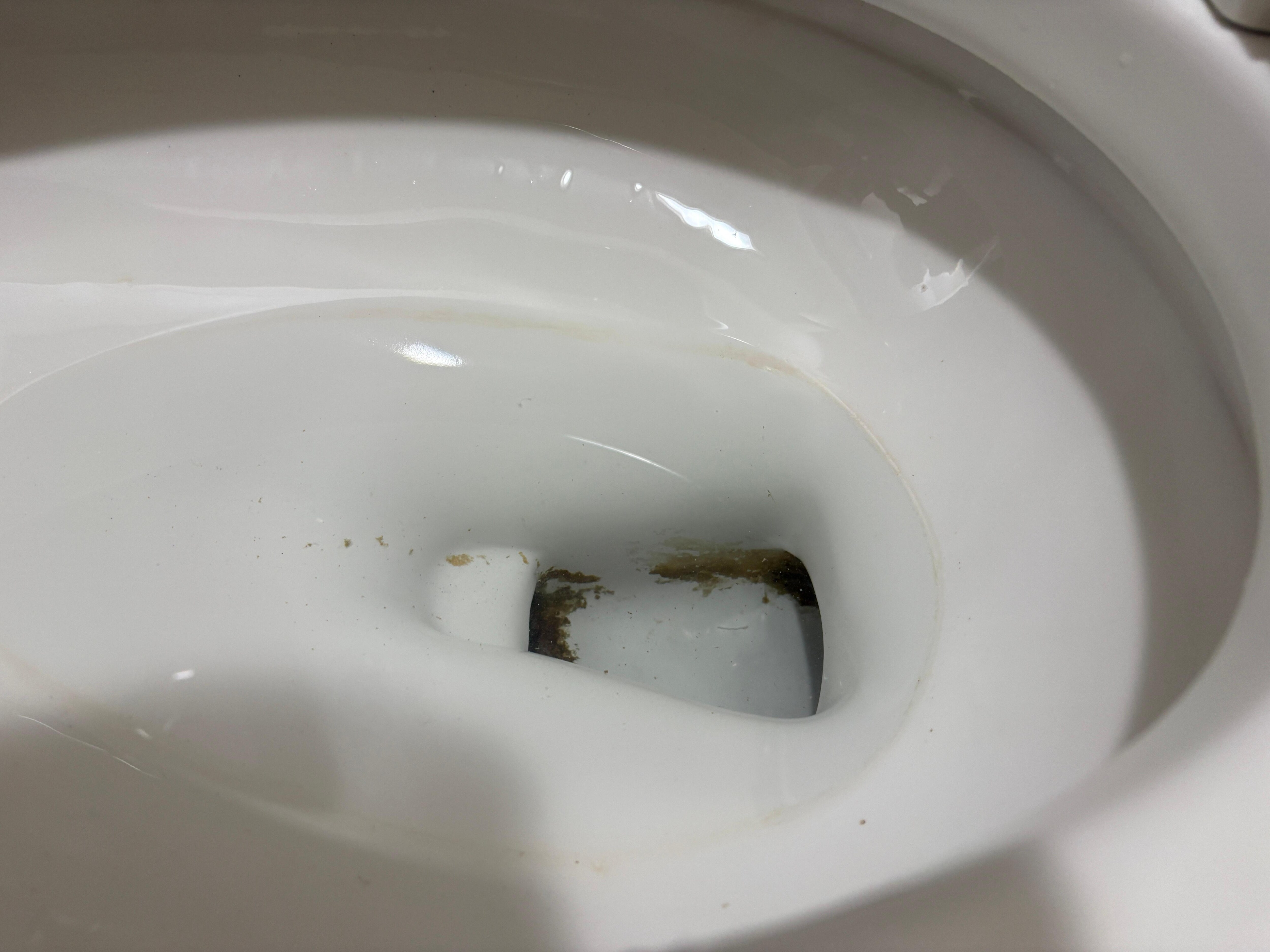 Poop