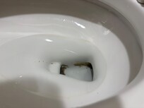 Poop