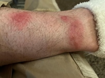 Malheureusement mon séjour à été gâché par des punaises de lit. J’ai fait une allergie donc je suis contraint de dire que les conséquences ont été horrible pour moi.