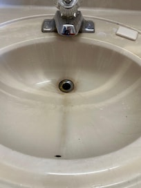 Sinks are dirty, and stained in both rooms.